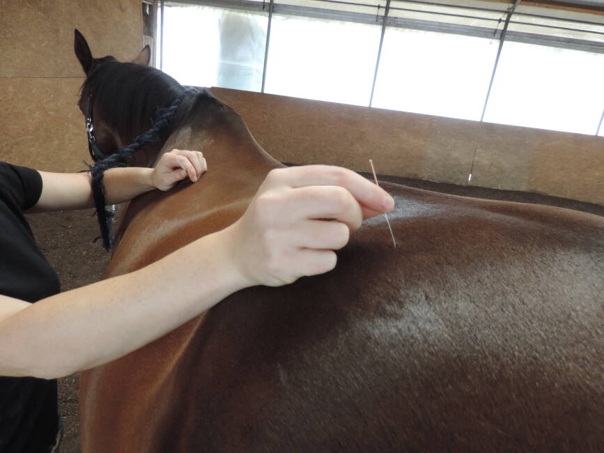 Nadelung eines Triggerpunkts des M. gluteus medius